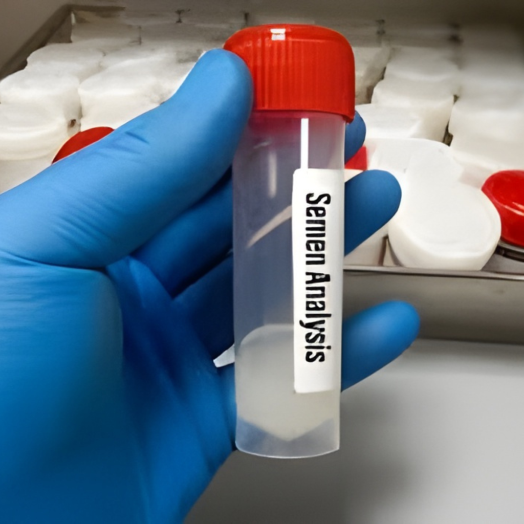 Semen Analysis Test Cost in India