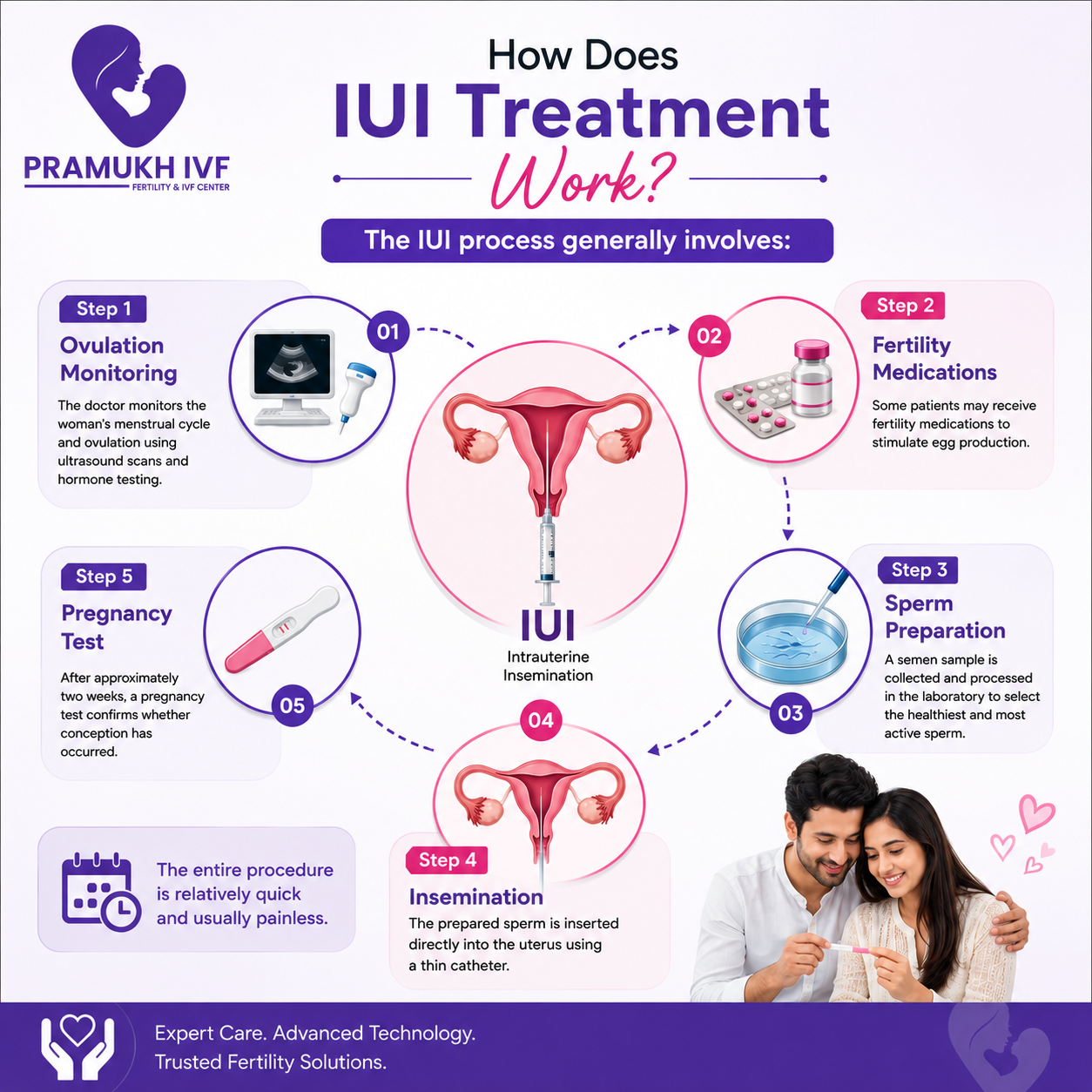 IUI Treatment